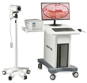Máy soi cổ tử cung kỹ thuật số